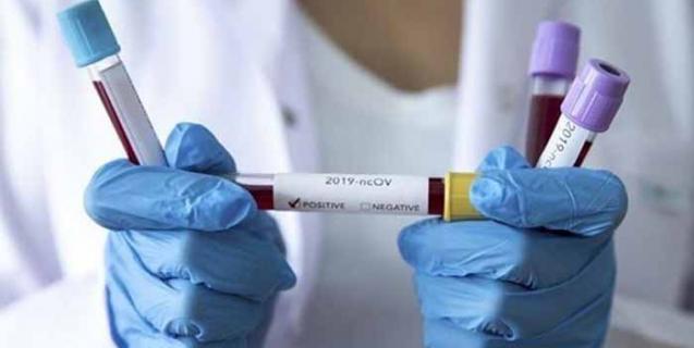 




На Черкащині – нові випадки захворювання на COVID-19


