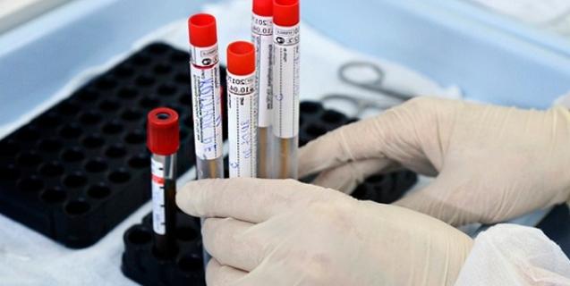 




На Черкащині зареєстровано 248 нових випадків COVID-19 за добу. В Україні – майже 9 тисяч


