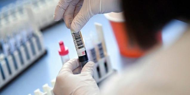 




За минулу добу в області підтверджено 730 нових випадків COVID-19. Географія поширення



