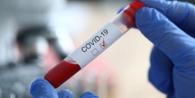 




Ознаки для визначення регіону зі значним поширенням COVID-19


